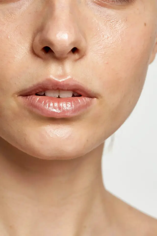 Hyperpigmentation Treatment for Sensitive Skin | Gentle Solutions for Brown Spots and Melasma | Skincare Tips